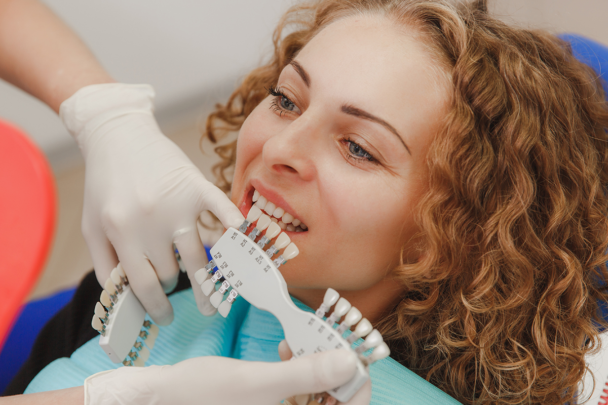 ¿Qué son las Carillas Dentales?