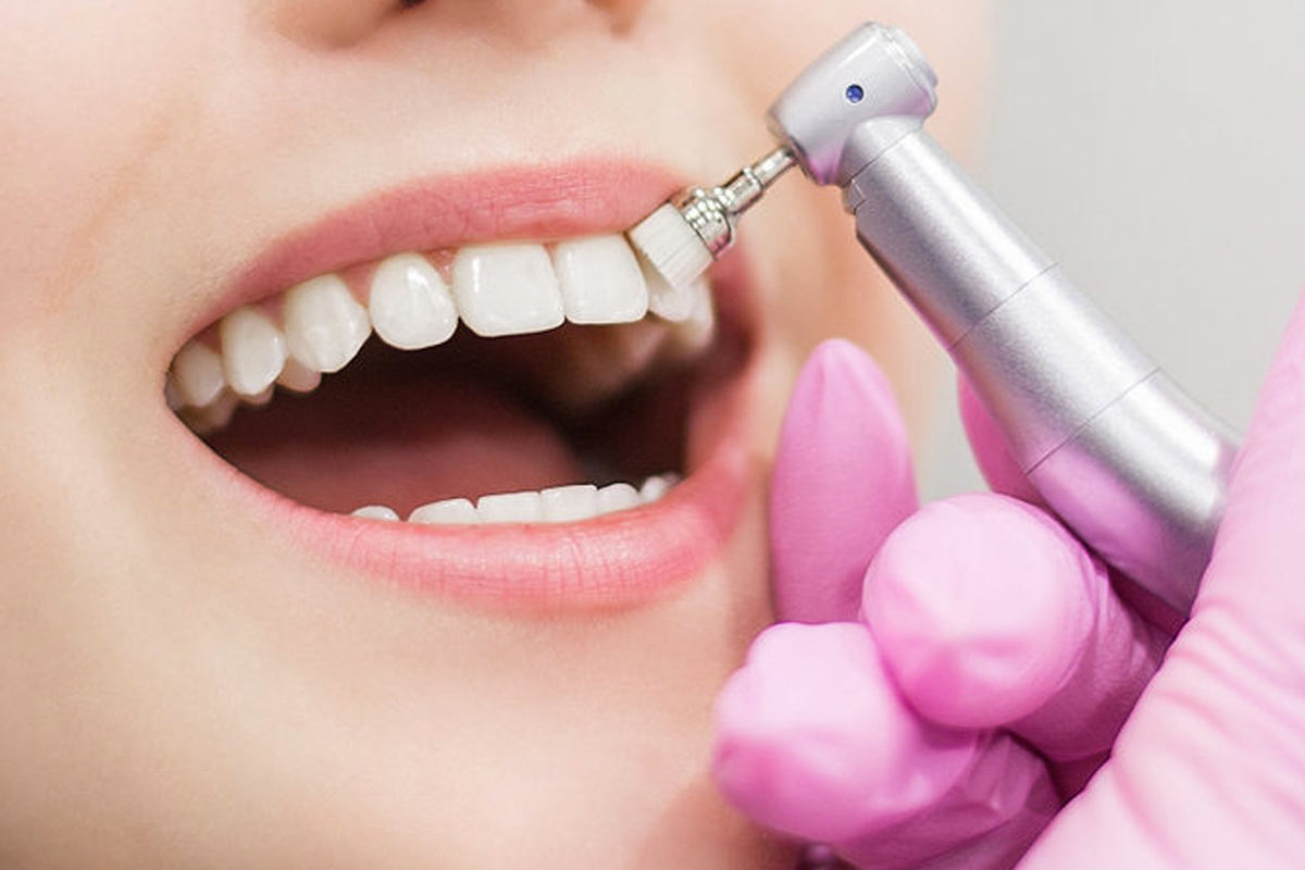 Beneficios de una correcta Higiene Dental