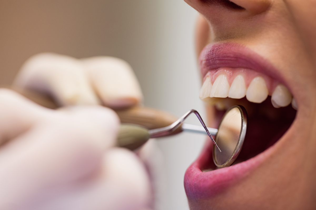 Tratamientos de Odontología Preventiva
