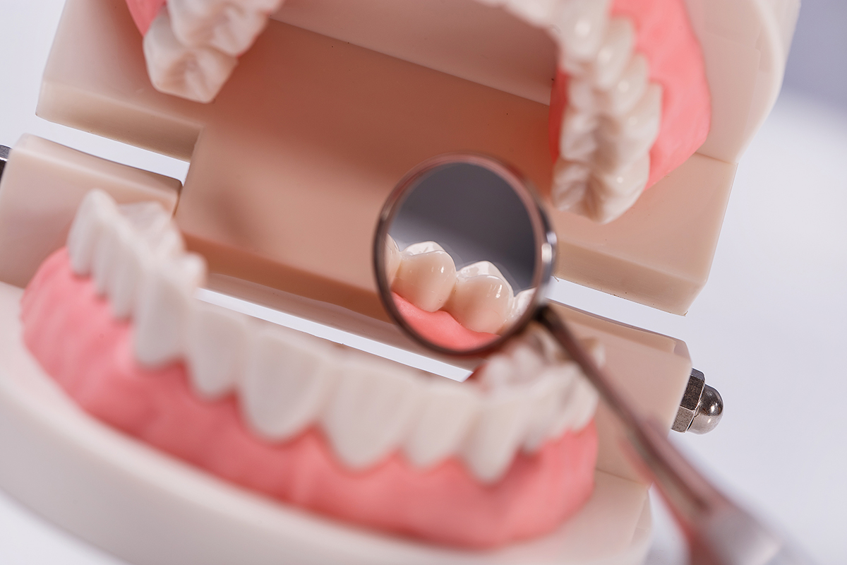 Tratamientos de Prótesis Dental